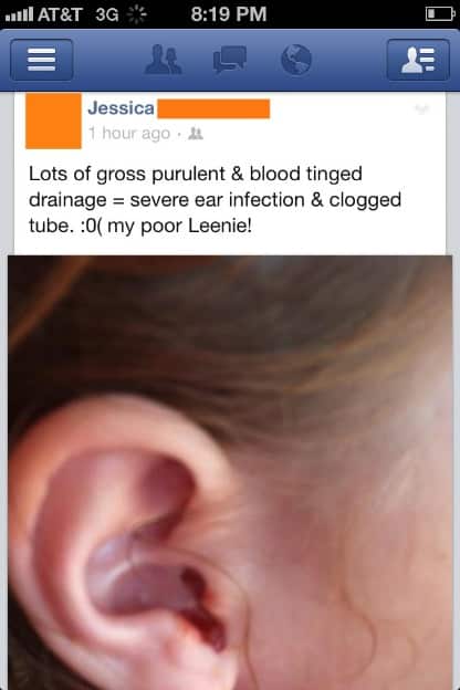 5. ear infection