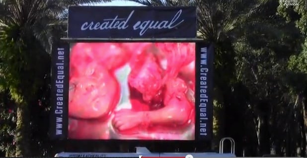 abortion jumbotron dismembered fetus picture