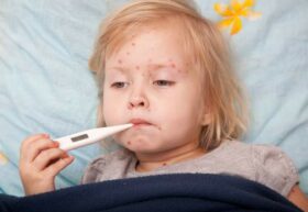 sick girl with measles