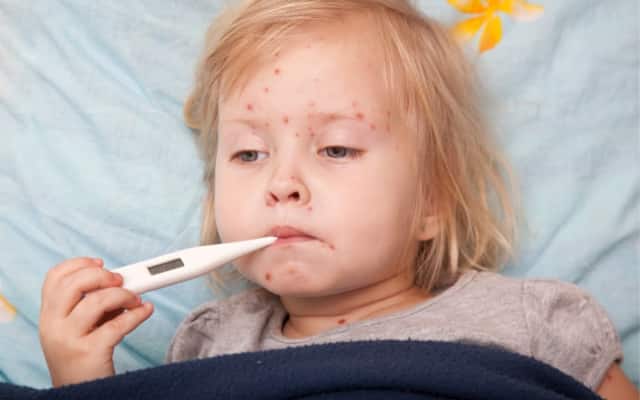 child sick chicken pox